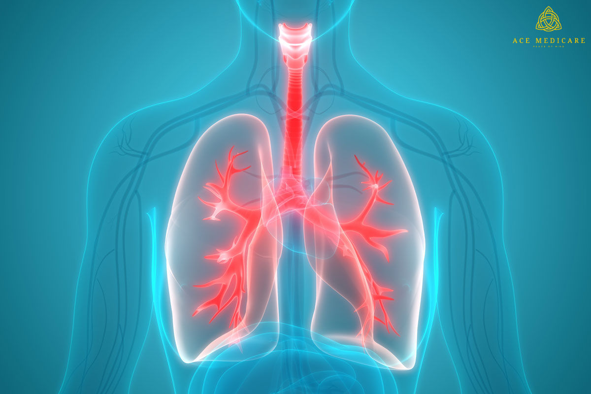 10 Tips for a Successful Lung Transplant Journey